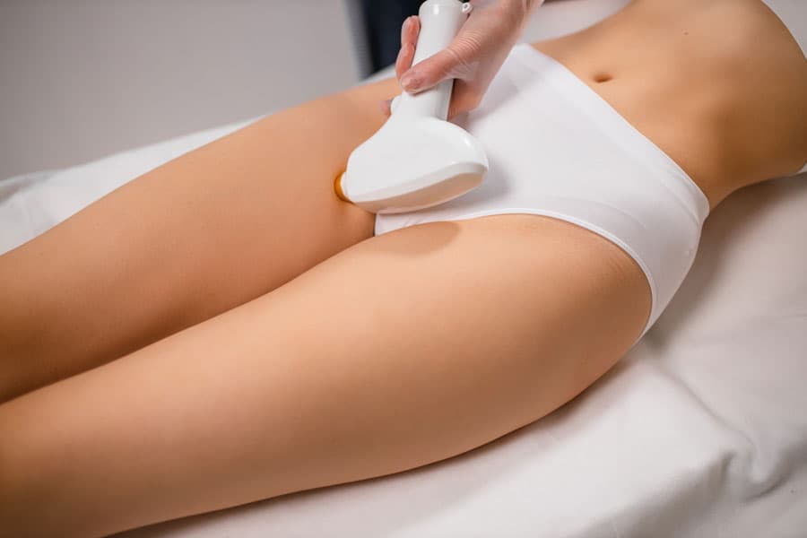 Técnicas de fotodepilación en el centro de estética Verivé